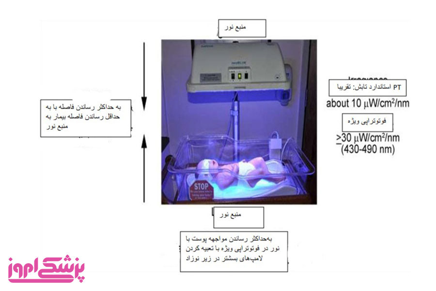 زردی| دستگاه زردی| نوزاد| پوست| به چه میزان باید فوتوتراپی صورت گیرد